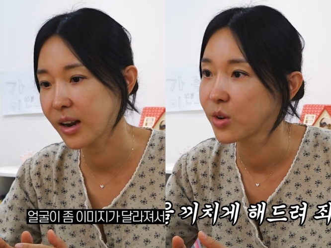<b>이지혜</b>, <b>시술 부작용</b>? 달라진 얼굴→촬영 취소…"공개하기로 결심, 용기...