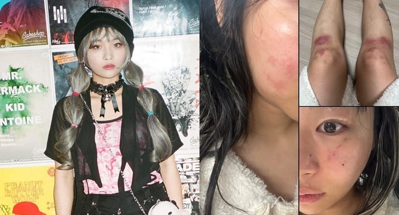 AOMG, <b>재키와이</b> '<b>데이트 폭력</b>' 피해 확인했다 "법률 자문 지원" (공식)[전...