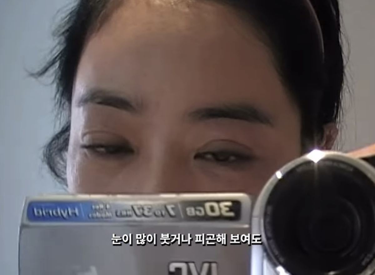 <b>이혜영</b>, 암투병 5년…후유증으로 퉁퉁 부은 눈 "많이 좌절해"
