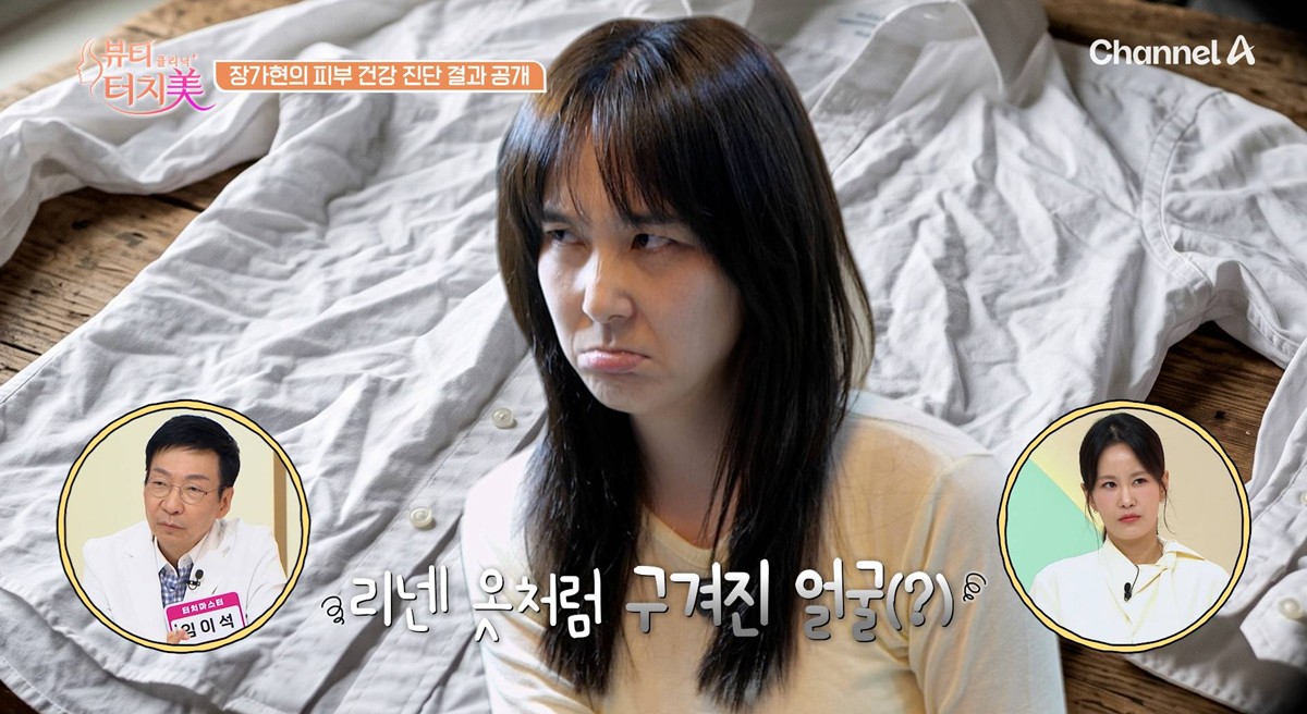 '50세' <b>장가현</b>, '55kg'에 집착하더니…얼굴선 무너졌다, 피부 건강도 적...