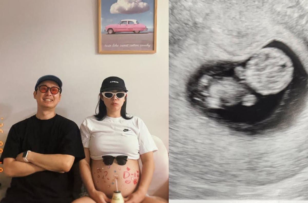 <b>설유진</b>, 결혼 9년 만 <b>임신</b>했다…"두 번 유산 후 <b>시험관</b> 1년, 기적처럼 찾...