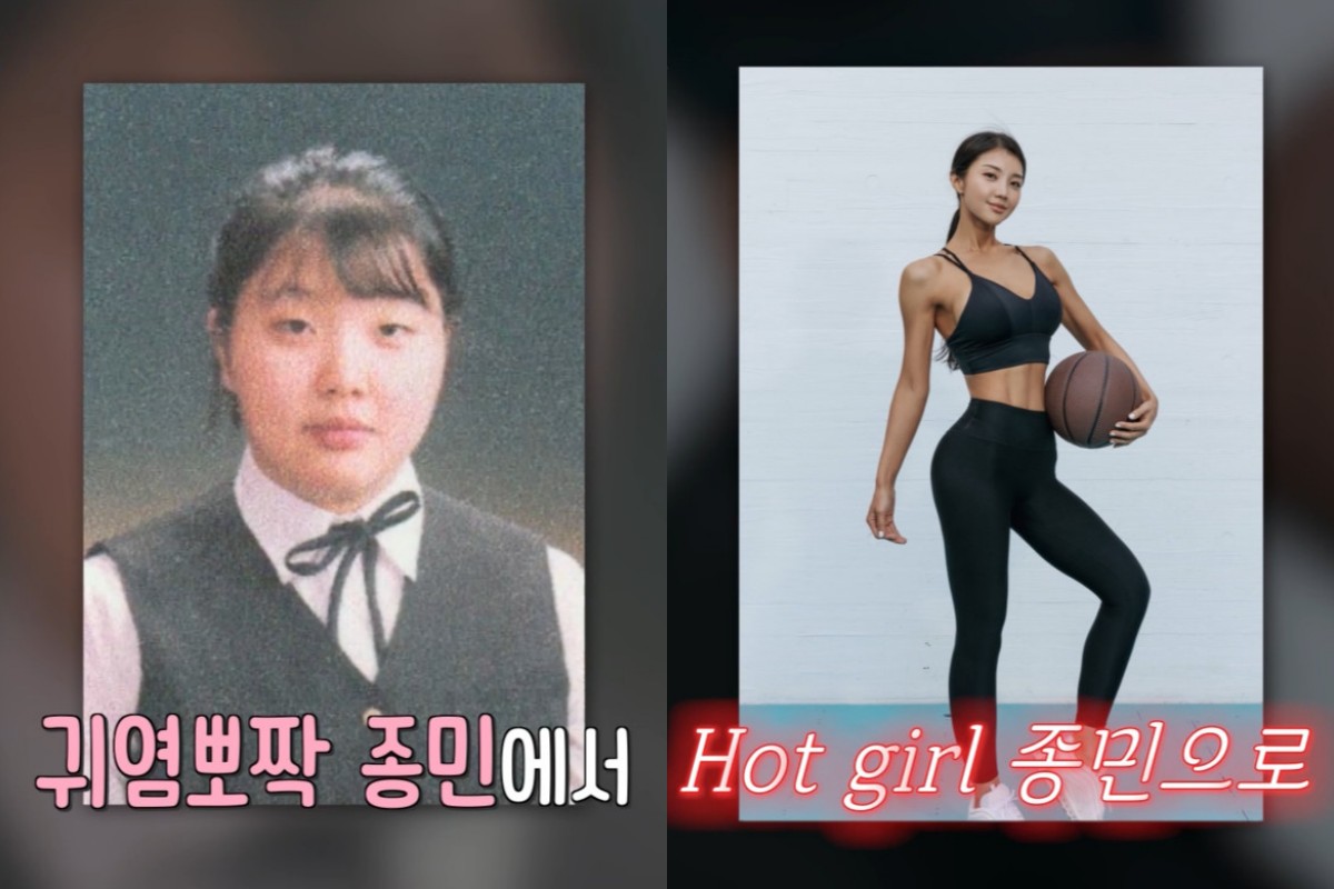 '48kg 감량' <b>이종민</b>, 하루 '8시간' 걸으며 독한 다이어트…"허벅지 피 나...