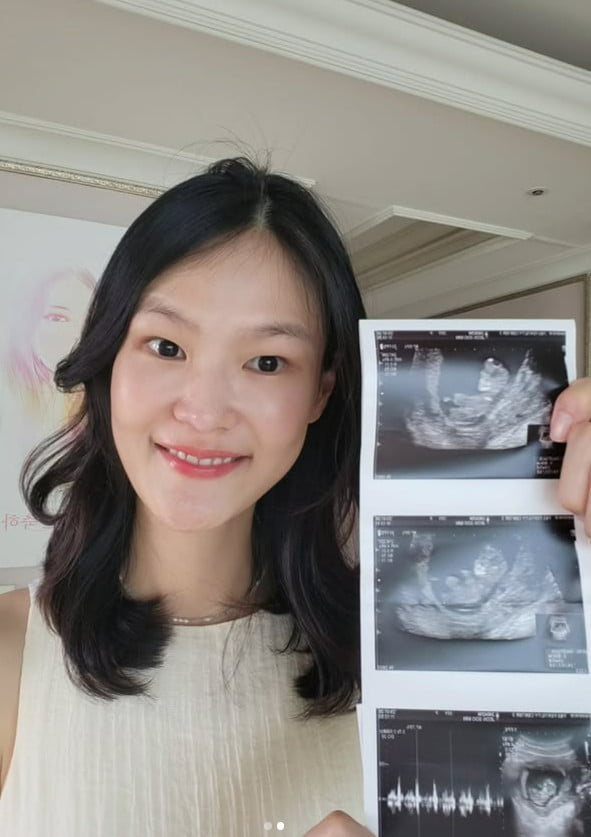 개그맨 <b>김경진</b> 아빠 된다…<b>전수민</b>, 결혼 4년 만에 '<b>쌍둥이</b>' <b>임신</b>