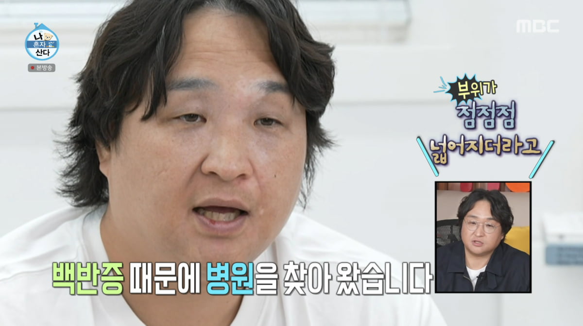 <b>구성환</b>, 난치성 질환 <b>고백</b>했다…"피부 <b>백반증</b>, 털이 하얗게 돼"('나혼산...