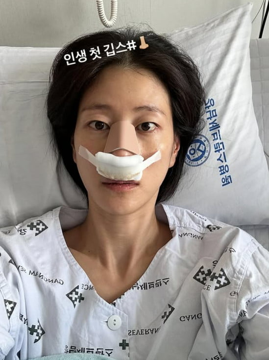 <b>이현이</b>, <b>코뼈 골절</b>로 인생 첫 깁스…"숨 못 쉬어 죽었을 것"