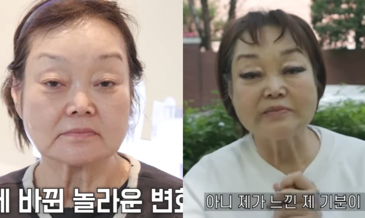 ‘69세’ <b>이혜정</b>, 실·콜라겐 넣고 쫙 보수하더니…“평생 예쁘단 소리...