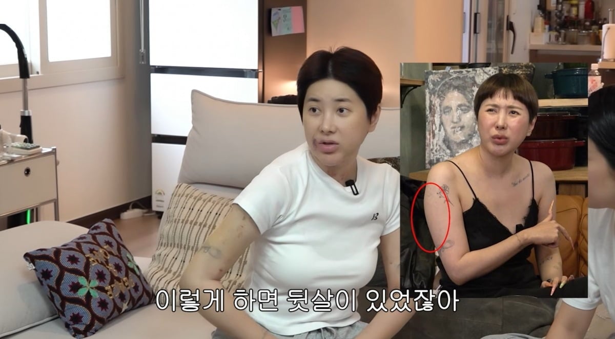 "워터밤 출연료 다 썼다" <b>서인영</b>, 팔에 푸른 멍 가득…"전신마취 후 지...