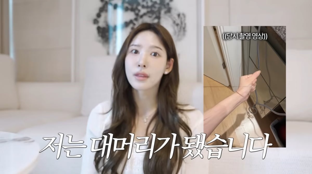 이나연, <b>모발이식</b> 부작용…"대머리 됐다, 30cm 날아가" ('일단')