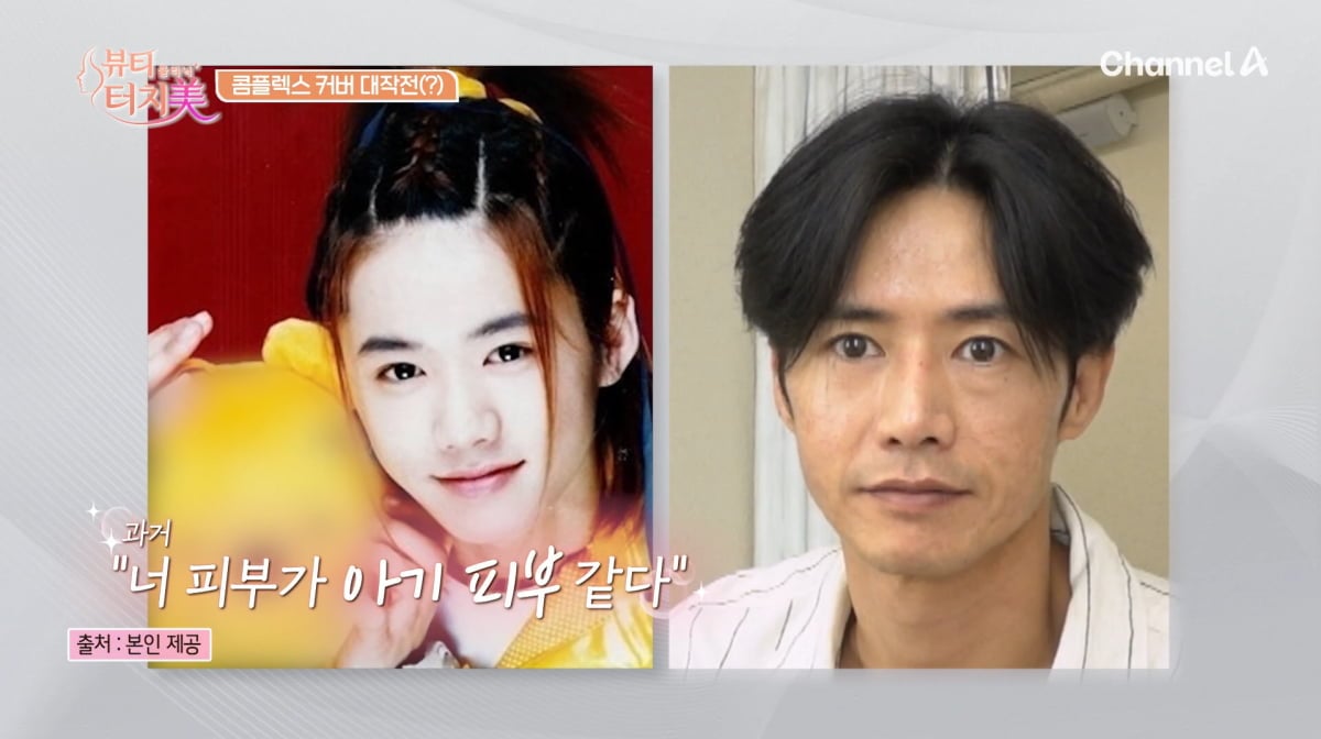 <b>오종혁</b>, '귤껍질 피부' 드디어 치료했다…되찾은 원조 꽃미남 비주얼 (...