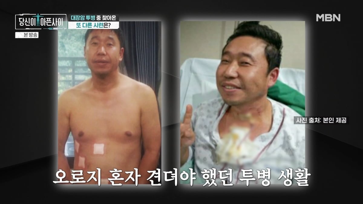 MBN「당신이 아픈 사이」で紹介された、治療中のイ・サンウンの写真2点。画面には「一人で耐えた闘病生活」と表示