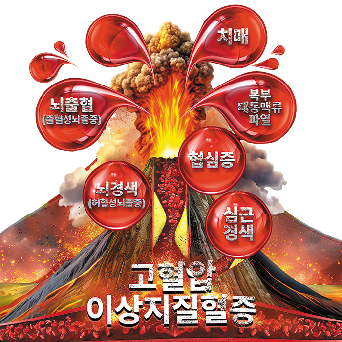 혈관 내에 콜레스테롤이 쌓이면 고혈압, 이상지질혈증이 유발된다. 두 질환은 심혈관질환등 각종 중증질환 발병 위험을 높인다. HDL콜레스테롤 수치를 높여 고혈압, 이상지질혈증을 예방·개선할 수 있다./레이델 제공