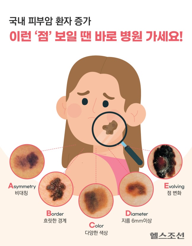 사진=헬스조선 DB