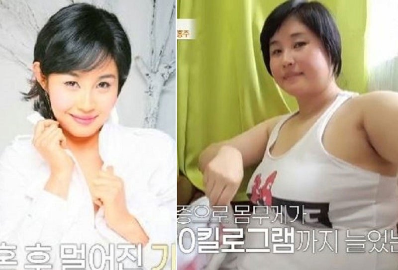 “우울증으로 폭식, 90kg까지 쪘다”… 女 <b>가수</b>의 고백, 누구?