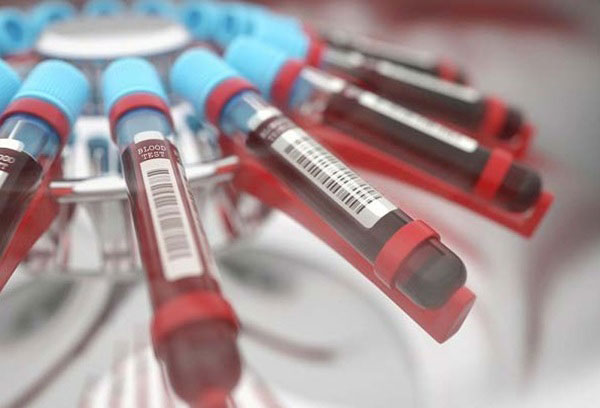 혈액형에 따라 자가면역 간질환 위험이 달라질 수 있다는 연구 결과가 나왔다./사진=클립아트코리아