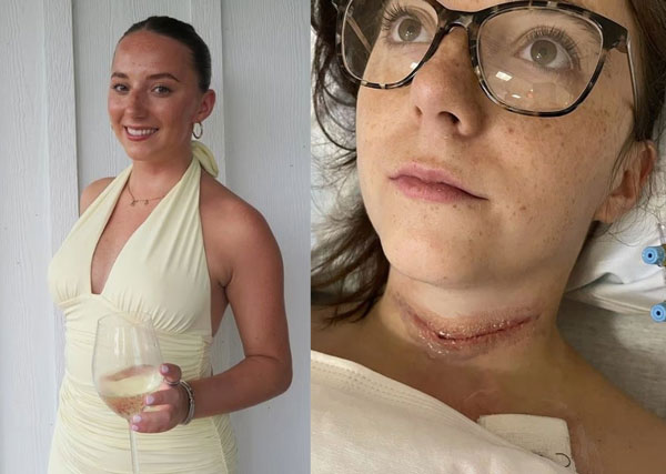 미국의 20대 여성이 자신에게 생긴 증상을 단순 피로로 인한 것으로 오인했다가 갑상선암을 진단받은 사연이 전해졌다./사진=데일리메일