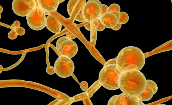 항진균제 내성을 가진 곰팡이가 전 세계적으로 확산해 문제가 되고 있다./사진=게티이미지뱅크