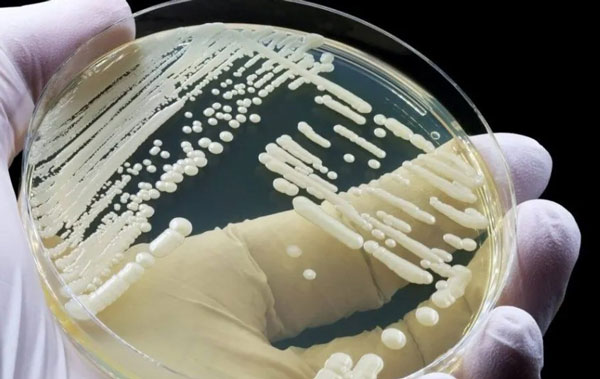 칸디다 오리스는 세포벽 단백질을 가지고 있어 인간 피부에 접착제처럼 달라붙어 생존할 수 있다./사진=mis 캡처