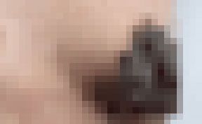 유두 색깔이 갑자기 까맣게 변한 30대 여성의 사례가 보고됐다./사진=큐레우스 