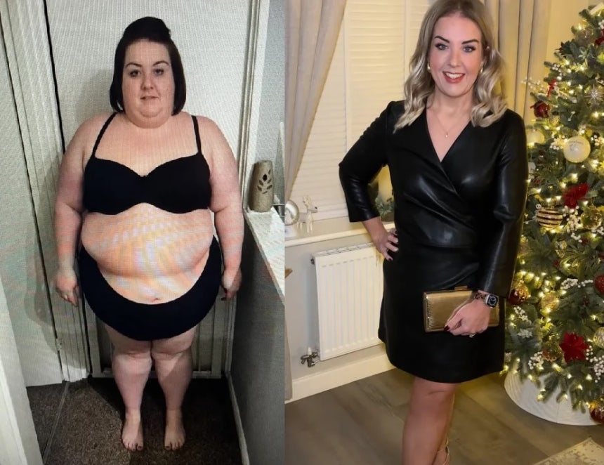 영국의 한 30대 여성이 음식 중독에서 벗어나 약 80kg을 감량해 화제가 됐다./사진=더선
