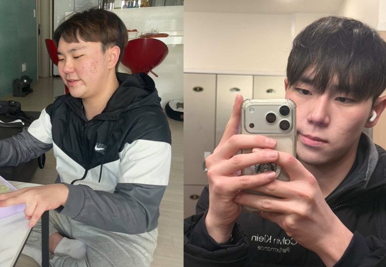 다이어트 전(왼)과 후(오) 장벼리씨의 모습./사진=장벼리씨 제공