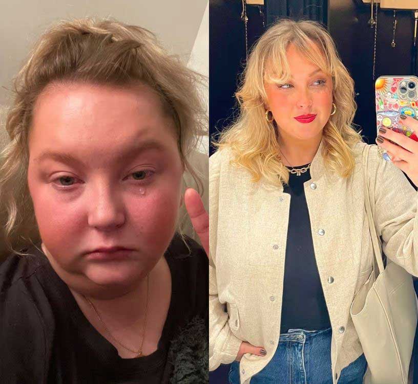 하루 2리터에 달하는 술을 마시다 시한부 판정을 받았던 20대 여성의 사연이 전해졌다./사진=미러