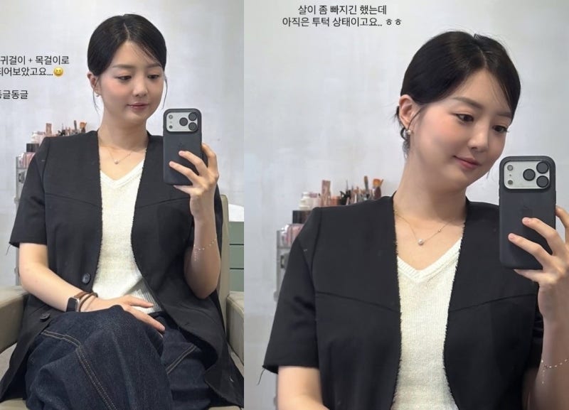 김소영도 고민하던데… ‘이중턱’ 대체 어떻게 없애나?