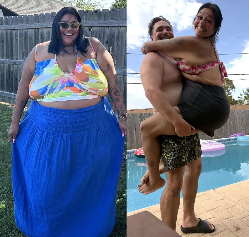220kg에 달했던 30대 여성이 주사 치료와 식단 관리에 이어 비만 수술까지 병행하며 총 136kg 감량에 성공했다./사진=더선