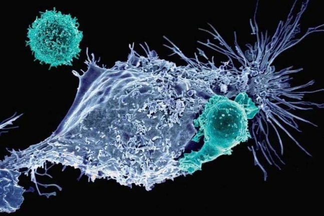키메라 항원 수용체T(CAR-T)세포(녹색)가 암세포(파란색)를 공격하는 모습. 한 종류의 암세포만 공격하는 CAR-T세포와 달리 모든 종류의 암세포를 공격하는 MR1T세포의 작동 원리가 최근 밝혀졌다./미 메모리얼