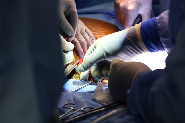 미국 매사추세츠 종합병원의 카와이 타츠오 박사는 지난 16일 62세의 미국 남성 리처드 슬레이먼에게 유전자 변형 돼지의 신장을 이식하는 수술을 시행했다./매사추세츠 종합병원
