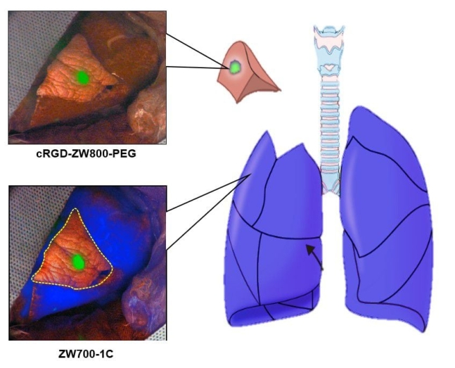 김현구 고대구로병원 심장혈관흉부외과 교수와 최학수 하버드 의대 교수 연구팀이 개발 중인 '이중 형광영상을 활용한 폐암 정밀 수술법'. 800㎚ 파장의 cRGD-ZW800-PEG, 700㎚ 파장의 ZW700-1C 조영