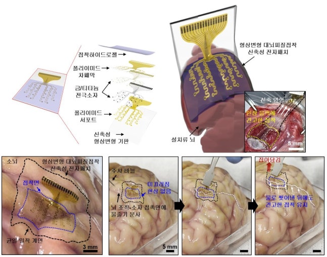 Overview and actual appearance of the shape-transforming cerebral cortex adhesive elastic electronic patch developed by the joint research team of IBS and KIST/IBS