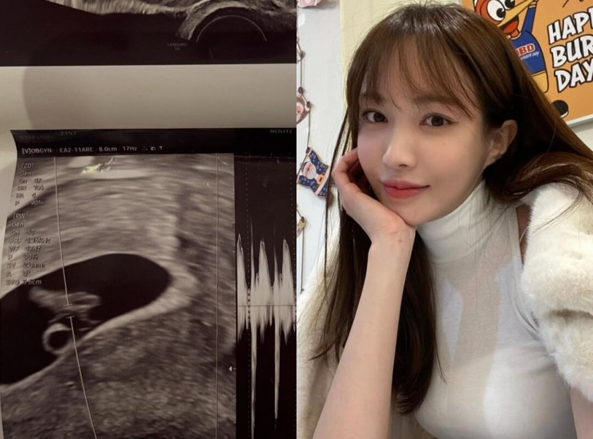 서민재 인스타그램