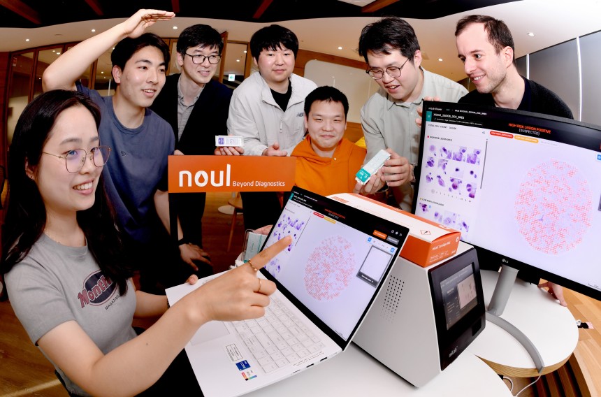 지난달 18일 경기도 용인시에 위치한 의료기기 회사 노을 직원들이 인공지능(AI)으로 자궁경부암, 말라리아, 혈액을 검사한 화면을 보고 있다. 의료기기에 세포를 염색한 카트리지를 넣으면 검사 결과가 화면에 나온다. 