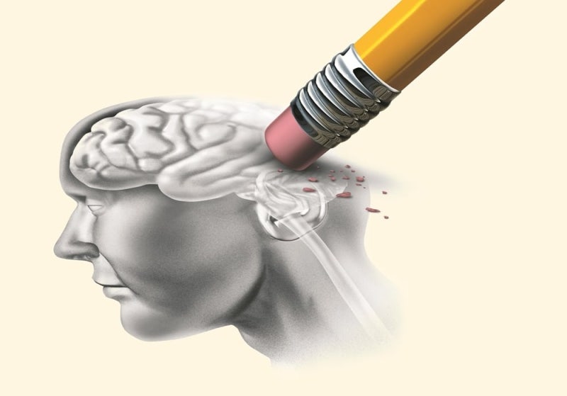 AI로 찾고, 뇌혈관 뚫고, 단백질 제거까지...치매 정복 나선 K바이오 - 뉴스 썸네일 이미지