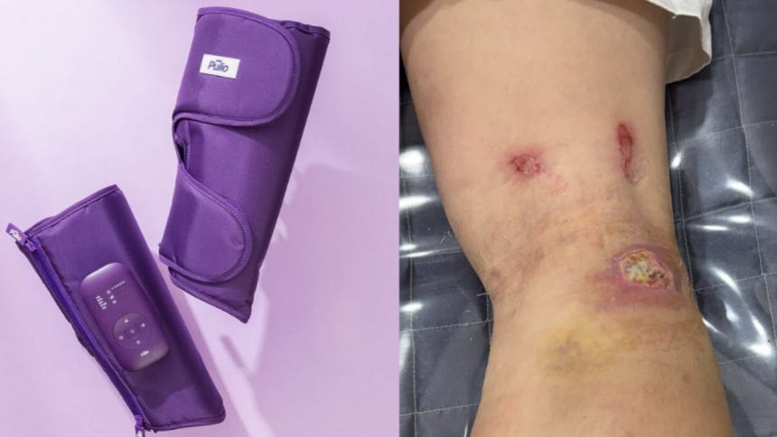 좌측은 풀리오의 마사지 기기. 우측은 저온 화상 모습. / 온라인 캡처