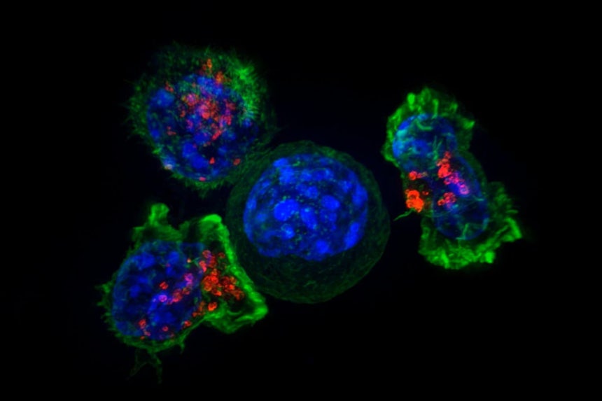 면역 세포인 T세포(녹색,붉은색)가 암세포(가운데 파란색)를 둘러싸고 공격하는 모습./미 NIH