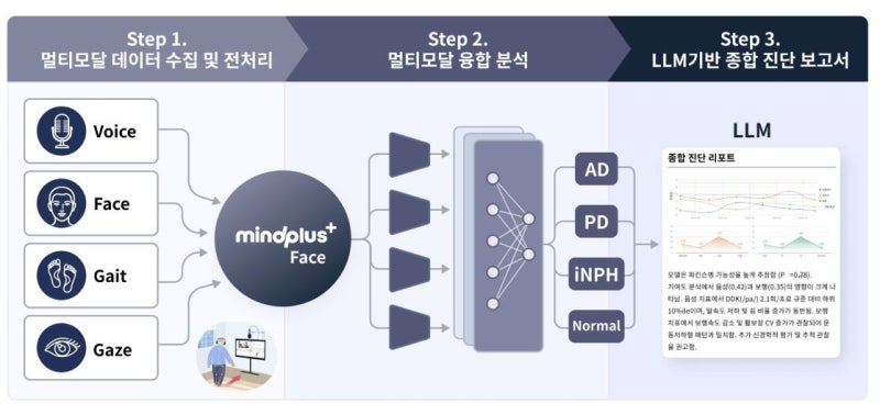 네오폰스, 범부처 첨단 의료기기 R&D 과제 선정 - 뉴스 썸네일 이미지