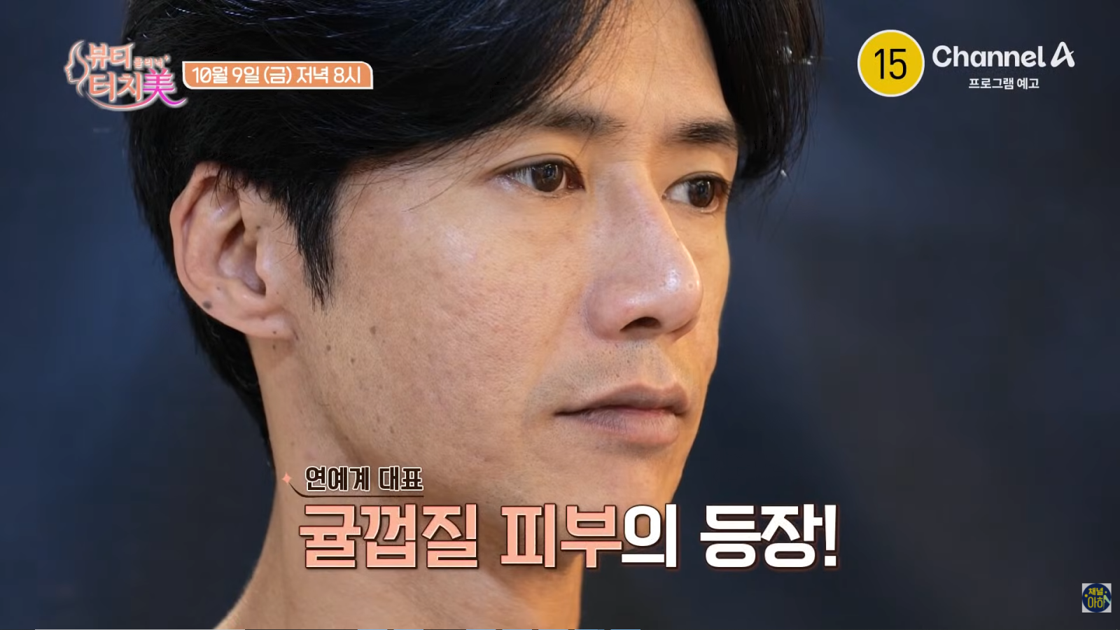 <b>오종혁</b>, ‘귤껍질 피부’ 감추려 두꺼운 화장…오히려 악순환