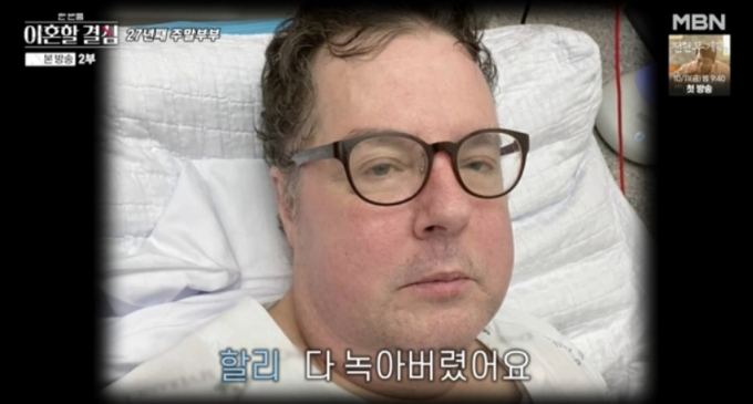‘이혼할 결심’ <b>로버트 할리</b>, <b>희귀암</b> 투병 고백 “근육 다 녹아 힘들었...