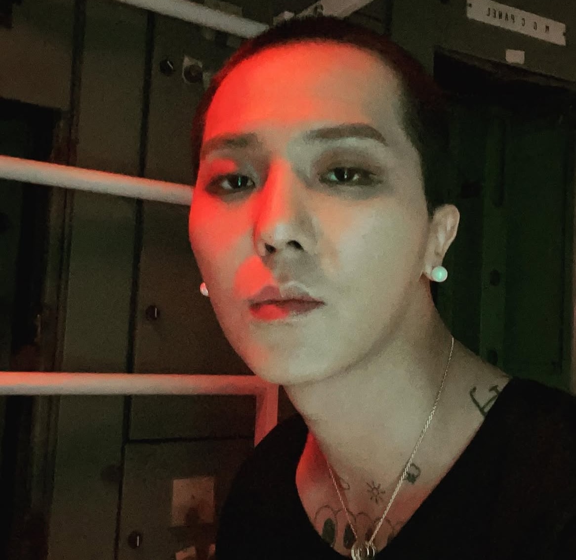 <b>송민호</b>, <b>교통사고</b> 뒤늦게 알려져…<b>후유증</b>으로 병원행
