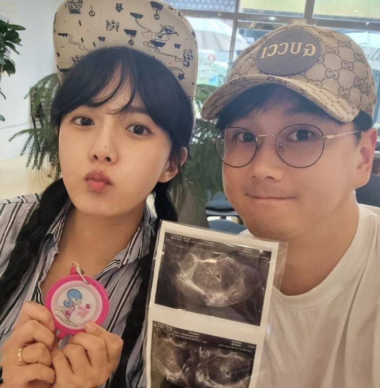 <b>강은비</b>, 40세에 자연<b>임신</b>…“내년 5월 출산 예정”[전문]