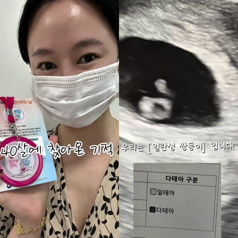 "0.4% 확률"…<b>오초희</b>, 유산 한 달만에 <b>쌍둥이 임신</b> [소셜in]