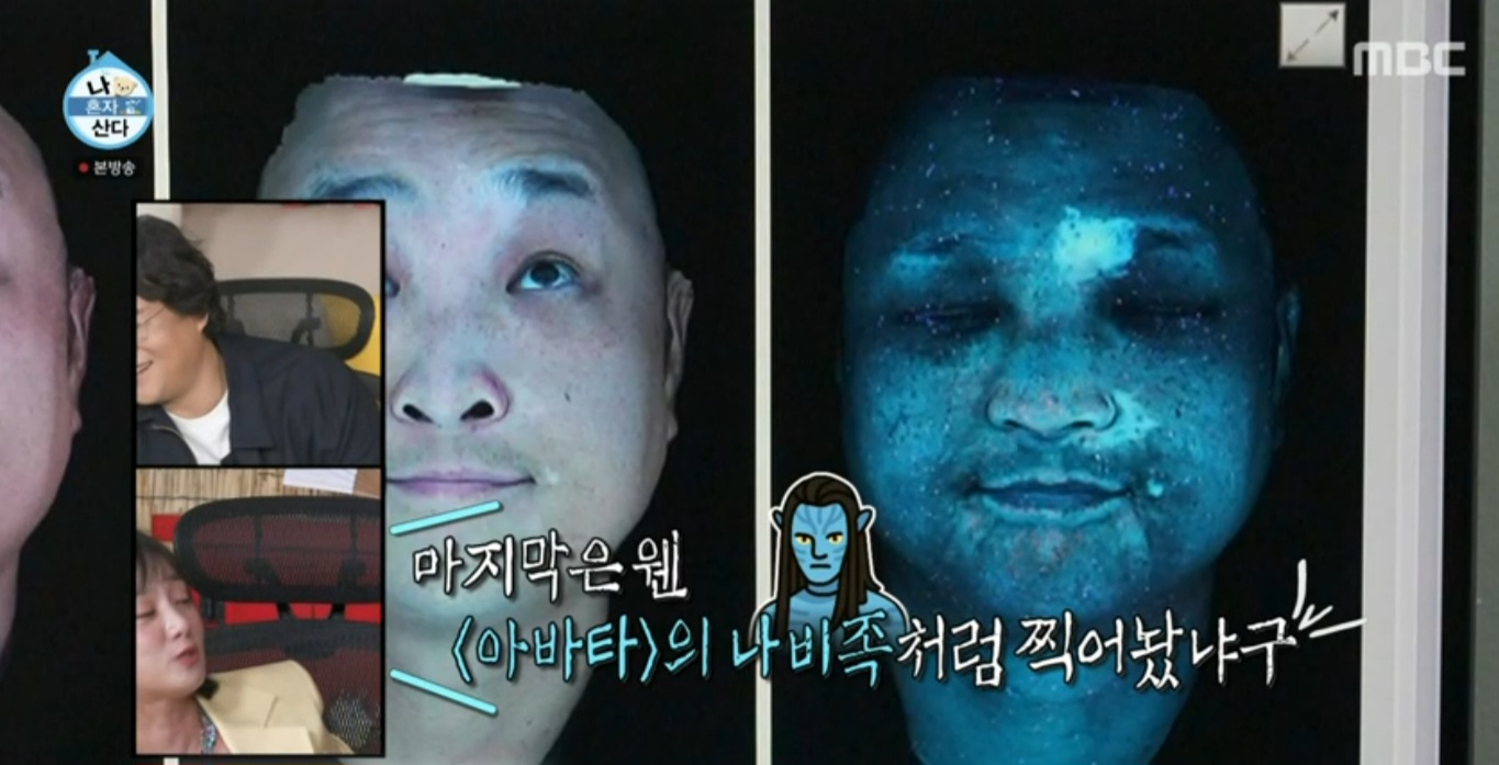‘<b>백반증</b>’ <b>구성환</b>, 심각한 피부 상태 “털도 하얗게 변해” (나혼산)