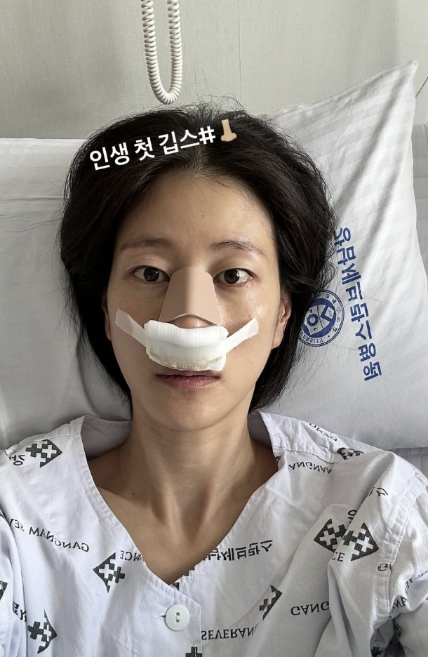 "<b>코뼈</b> 부러졌어요"…<b>이현이</b>, 축구 경기 중 결국 [소셜in]