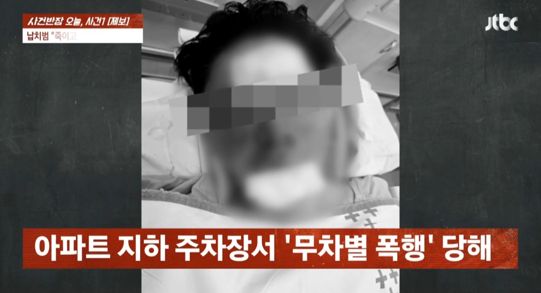 ‘100만 <b>유튜버</b>’ <b>수탉</b>, <b>납치</b>→무차별 폭행당해…얼굴 피해 심각