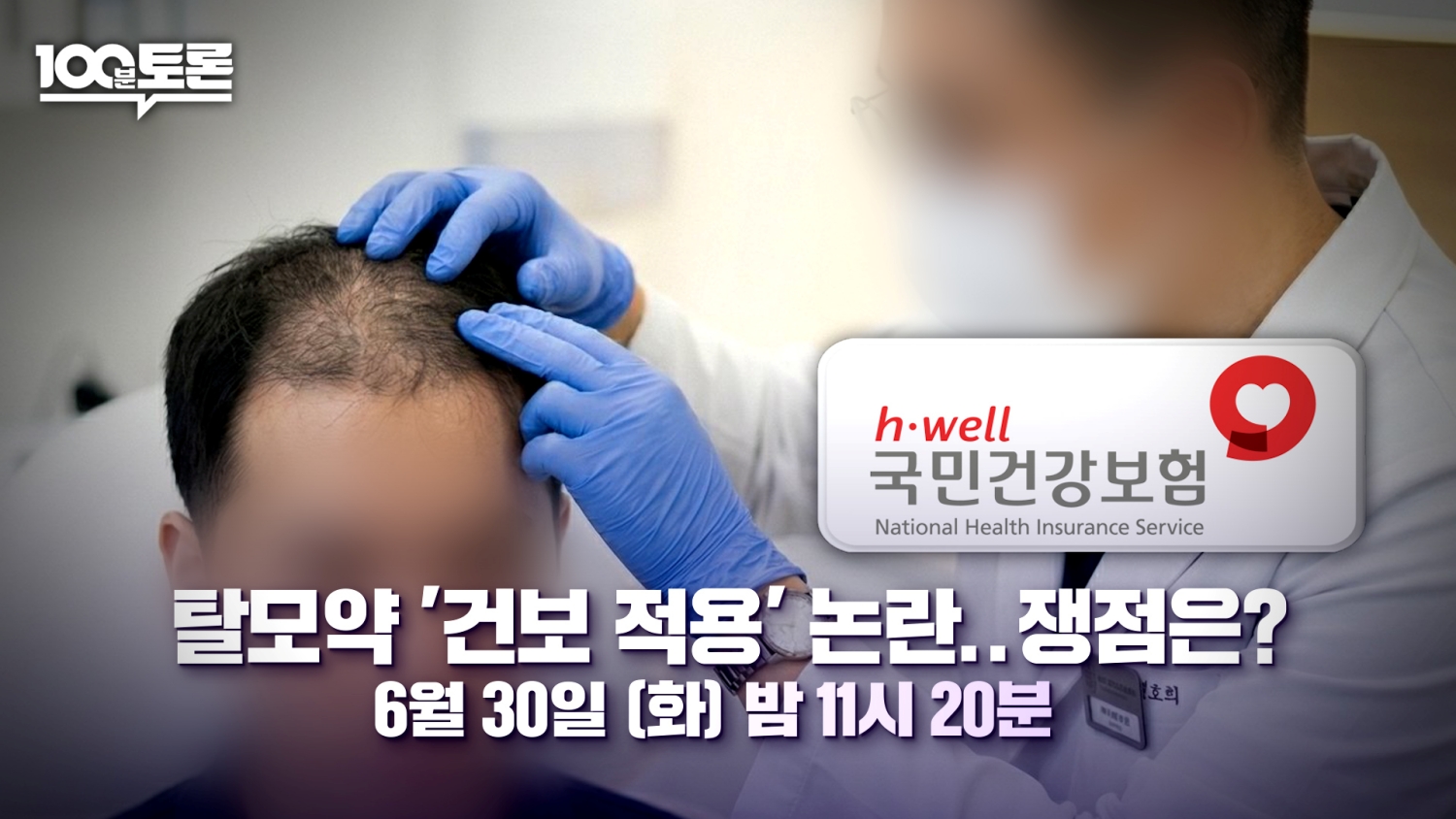 탈모약 건강보험 적용 논란…'<b>100분 토론</b>'서 쟁점 짚는다