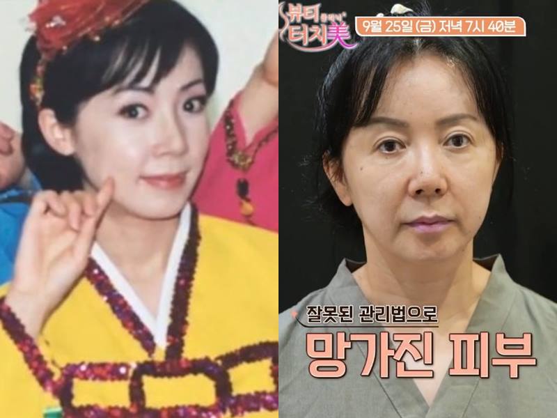 <b>김혜영</b>, 세 번 <b>이혼</b>+사업 실패로 <b>급속 노화</b> “8년 쉬었다” (터치미)