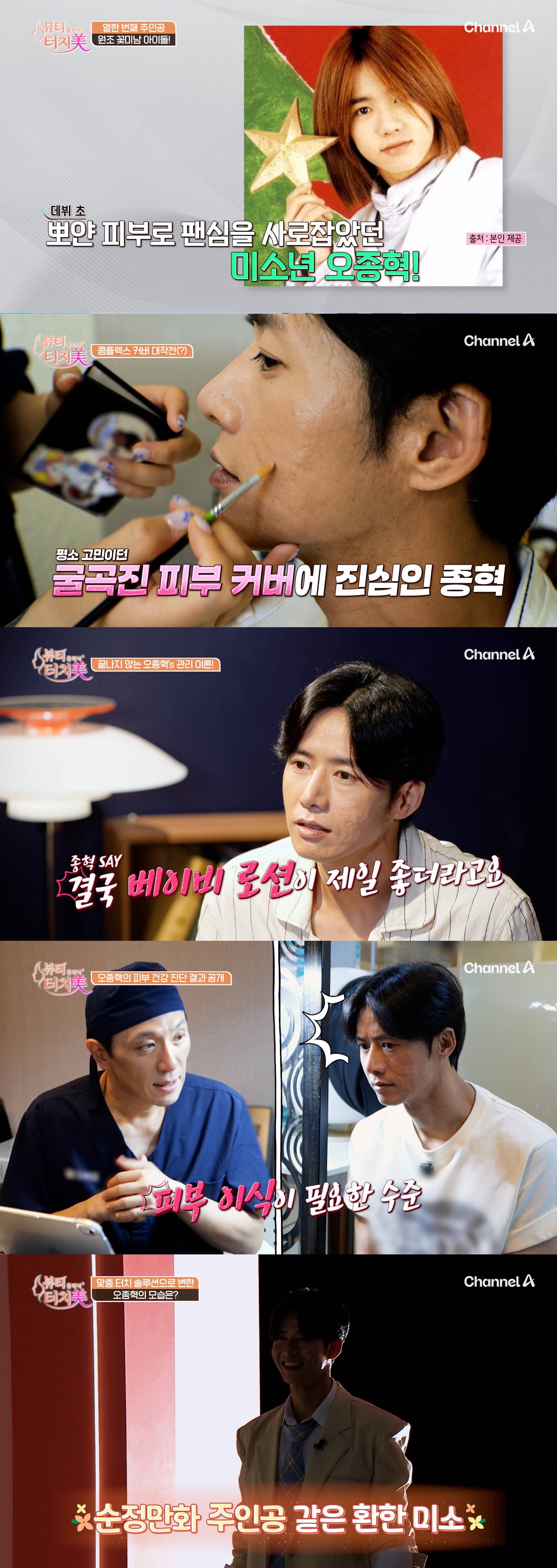 <b>클릭비 오종혁</b>, ‘귤껍질 피부’ 어쩌나…“피부 이식 필요한 수준” (...