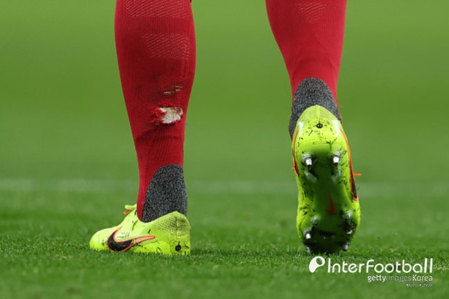 스타킹이 찢어질 정도로 밟았는데? 토트넘 감독은 "난폭한 태클 아니야, 레드카드 마음에 들지 않아"