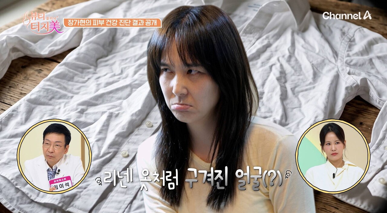 이혼한 지 6년…<b>장가현</b>, 몸은 날씬한데 무너진 피부 "유산소 운동 탓"